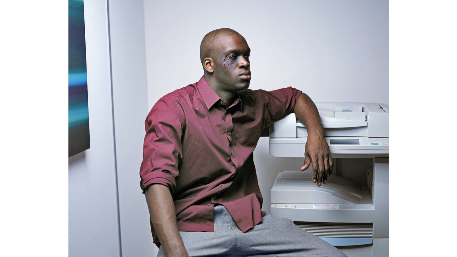 Office worker bleeding from head injury leaning against printer in office